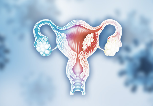 全球首例! 免疫细胞疗法完全治愈宫颈癌